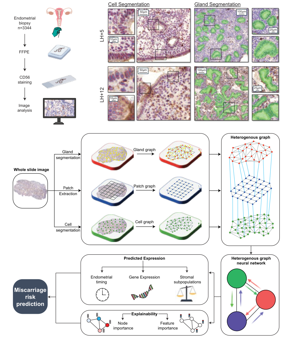 Overview of EndoMetronome model architecture